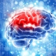 درمان سکته مغزی چیست؟